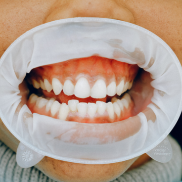 teeth white natural